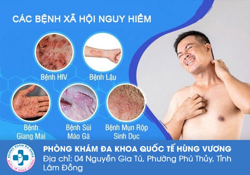 Các căn bệnh xã hội nguy hiểm thường gặp hiện nay.